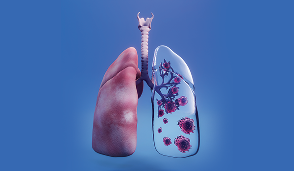 Bir Olgu Nedeniyle İkinci Primer Akciğer Karsinomlarının Değerlendirilmesi